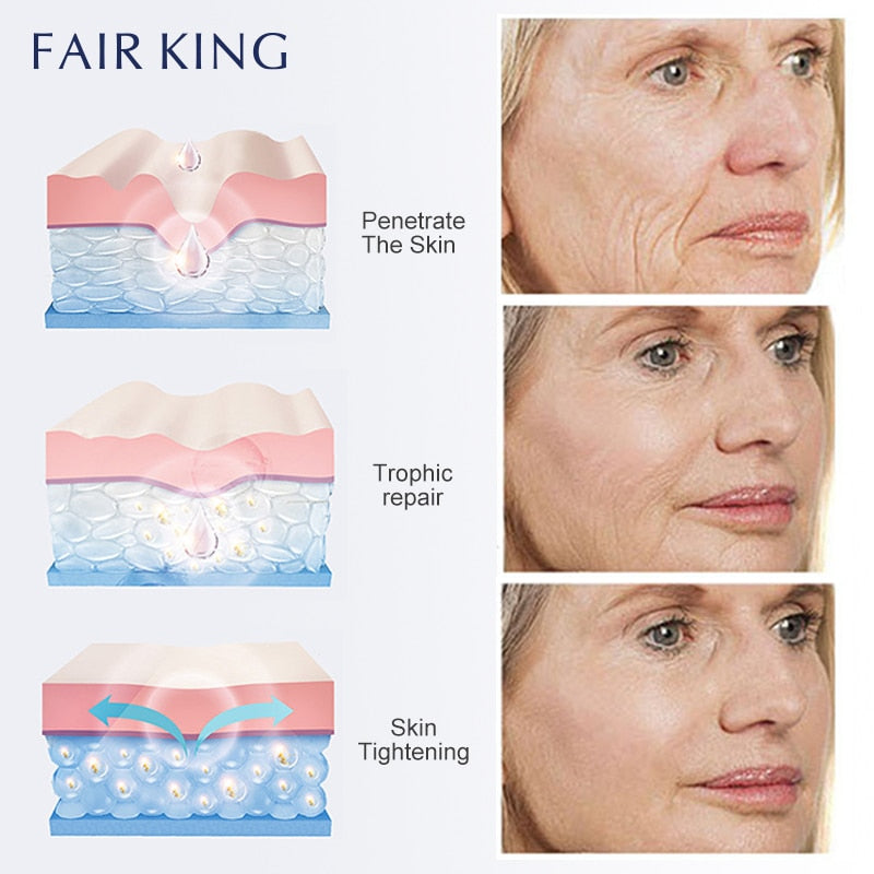 Reduce the appearance of fine lines and wrinkles with the Fairking