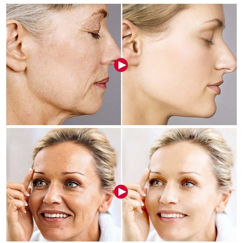 "Snail Secretion Filtrate Cream with Hyaluronic Acid: A Moisturizer for Anti-Wrinkle and Anti-Aging benefits"