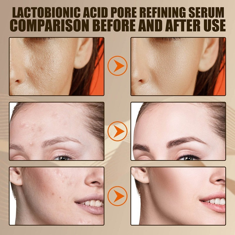 Amazing-Achieve a clearer and more youthful complexion