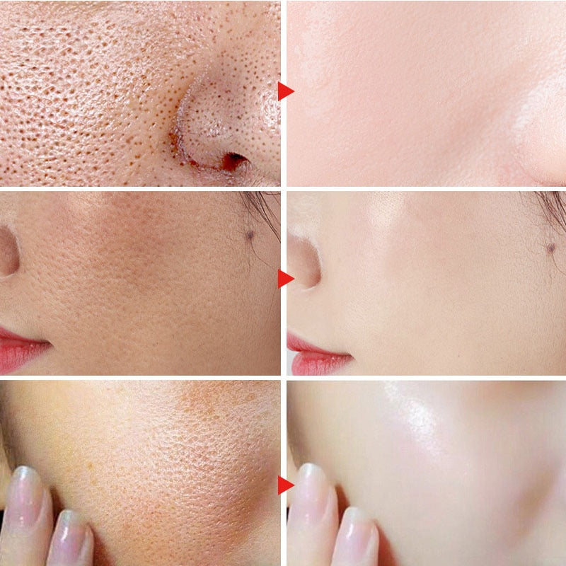 Amazing-Achieve a clearer and more youthful complexion