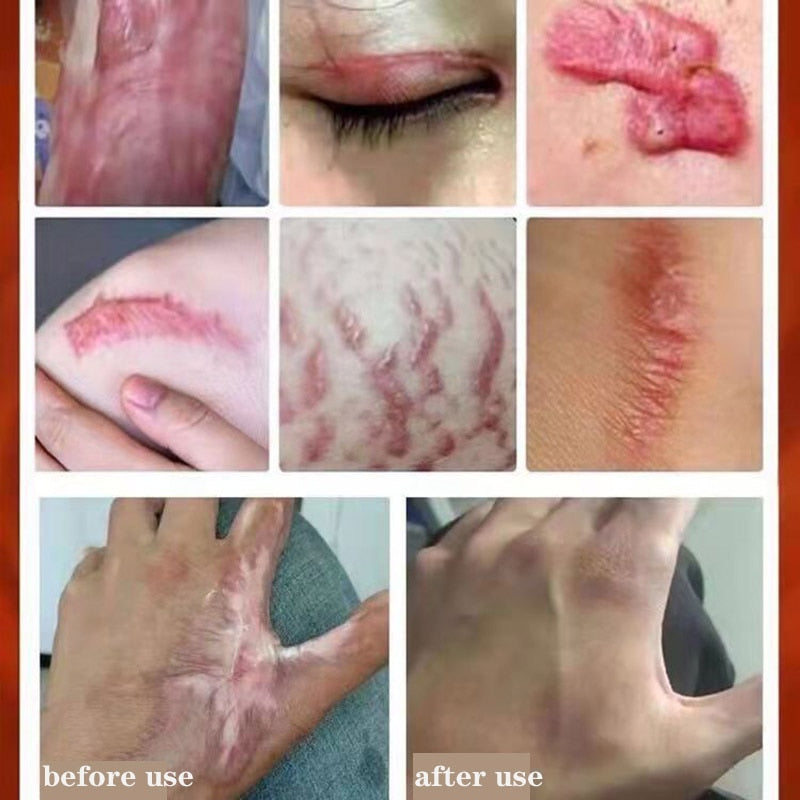 Revitalize your skin and diminish the signs of aging