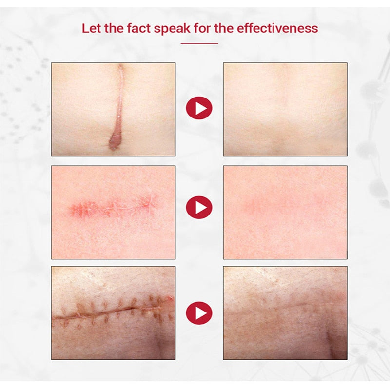 Revitalize your skin and diminish the signs of aging