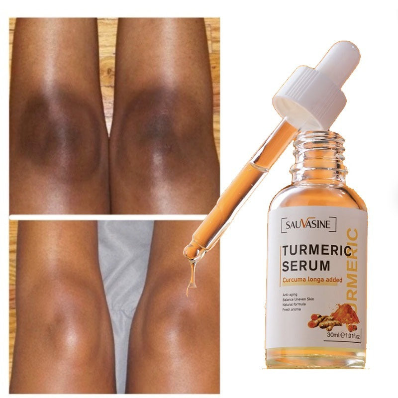 "Radiant Skin Glow Oil: Turmeric and Lemon Oil Lighten Dark Patches and Acne Scars"